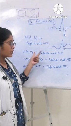 10 SIMPLE STEPS TO INTERPRET AN ECG