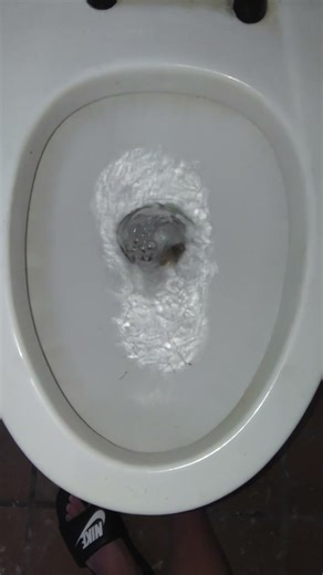 1980s American Standard Afwall Toilet At A Park!