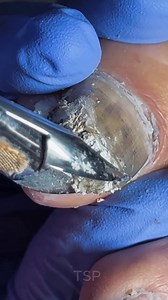 234K views · 2.3K reactions | Removing old nail safely and softly 﫧 | Pictures of Art | Facebook