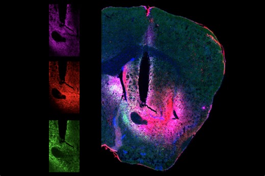 New dopamine sensor powers three-color imaging in live animals