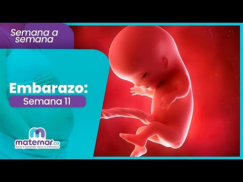 11 Weeks Pregnant: This Is the 11-Week Ultrasound You Need | Maternar.co
