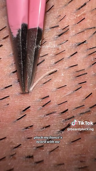 Plucking My Fiancé's Thick Beard Hairs Together