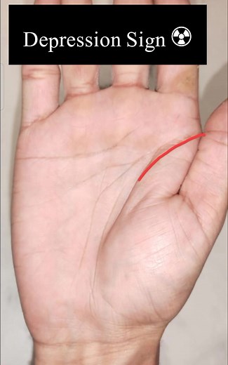 Understanding Depression Signs through Palmistry