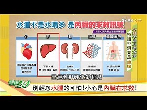 別輕忽水腫的可怕！小心是內臟在求救！ 健康2.0