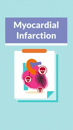 Quick breakdown of Myocardial Infarction (Heart Attack) with Nurse Mike!🫀 #myocardialinfarction #heartattack #nursing #nursingnotes #nursingschool