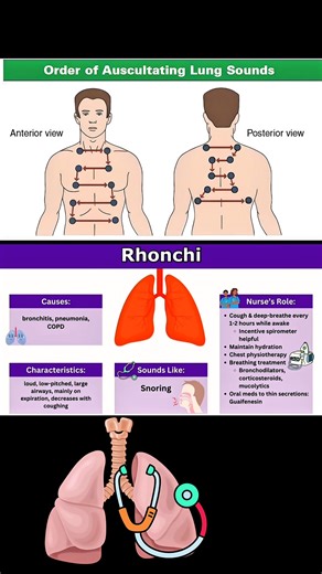 Lung sounds | Abnormal lung sound #listen #fblifestyle #doctors #MedG | Med G