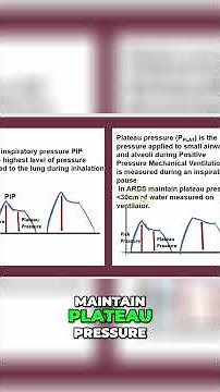 2-Minute Respiratory Therapy - Mechanical Ventilation - Trigger, volume vs pressure #shorts
