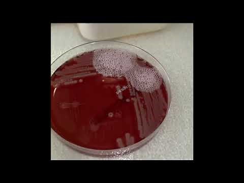 Catalase's test - Teste da Catalase (diferenciar Staphylococcus)