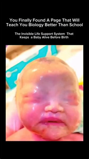 Explaining Biology on Instagram: "The Amniotic Membrane: The Baby’s Natural Life-Support System From the start of pregnancy, the amniotic membrane surrounds the developing baby, forming a thin yet powerful protective layer inside the womb. It creates the amniotic sac, filled with fluid that provides a safe and stable environment for growth 🤍 This membrane cushions the baby from external pressure, helps maintain a steady temperature, and allows gentle movement needed for healthy muscle and bone 
