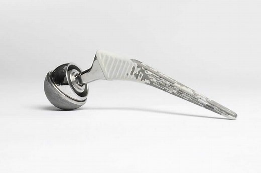 Metal on Metal Hip Replacement Lawsuits & Settlements