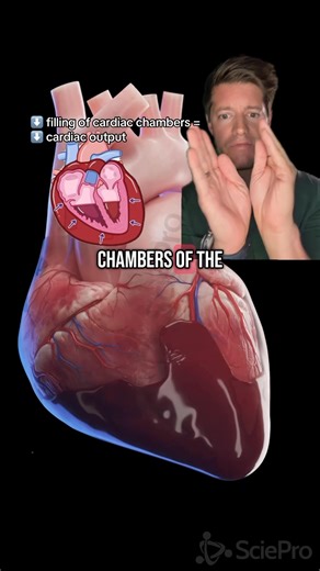 The treatment for pericardial tamponade is a heroic procedure called a pericardiocentesis, during which, a needle is placed through the pericardial sac and the fluid is drained. This relieves pressure on the outer walls of the heart, increases cardiac filling, and improves cardiac output. According to my favorite medical search engine, @OpenEvidence , surgery (pericardotomy or pericardial window) is indicated “for tamponade due to aortic dissection, trauma, ongoing bleeding, or when percutaneous