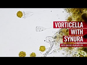 Vorticella plays ball | by Motic Europe