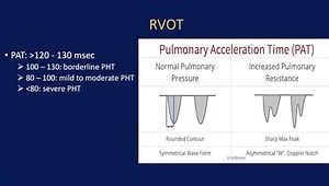 Continued Basics of Doppler