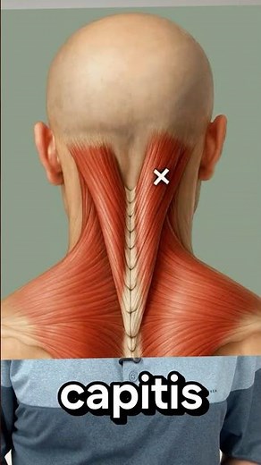 That Headache Behind Your Eye? It’s Not What You Think