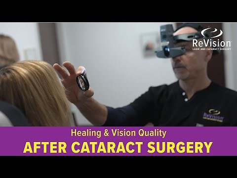 Recovery & Vision Expectations After Cataract Surgery