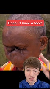 She is 77 years old and she uses her mouth to breath. Idea credit- @dereckramireztv #tiktokforgood #positivity#535 | Lukas Caldwell