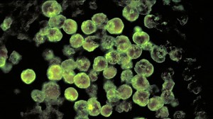 Florida residents warned about tap water after man dies from brain-eating amoeba