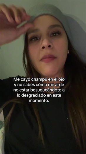 Me cayó champú en el ojo y duele: cómo aliviar la quemazón