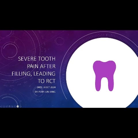 ✨ From unbearable tooth pain to total relief—thanks to Spooky2! ✨...