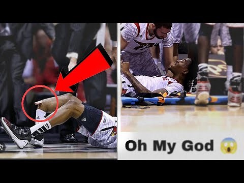 Kevin ware injury on March 31, 2013, during the NCAA Men's Basketball Tournament