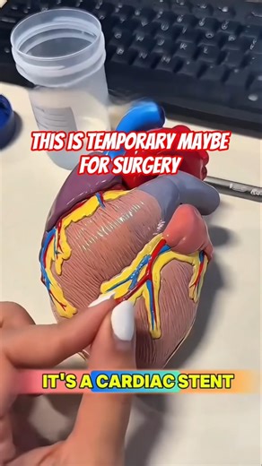 wow this nice for surgery #shortvideo