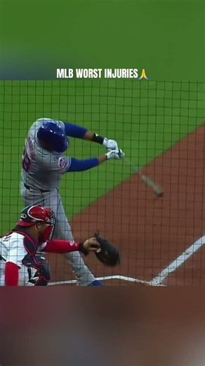 MLB worst injuries