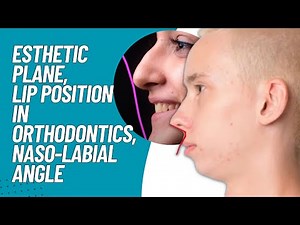 Esthetic Plane, E-Line, Lip Position in Orthodontics, Naso-Labial Angle