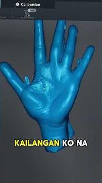 3D Printed Splint para sa Trigger Finger #drshiela3dprints