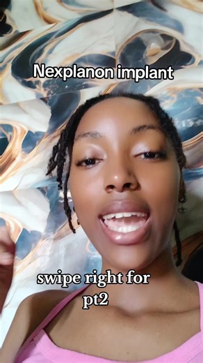 Nexplanon Implant Experience and Advice