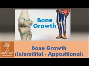 Interstitial vs Appositional Growth - Growth of Bone