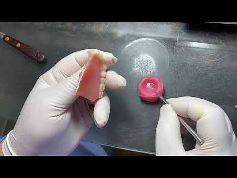 Trick to Gluing a Broken Denture