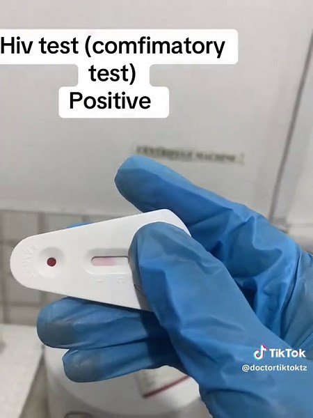 #hiv #kenyantiktok🇰🇪 #trendingvideo #viral_video #doctor #tanzaniatiktok #fypp