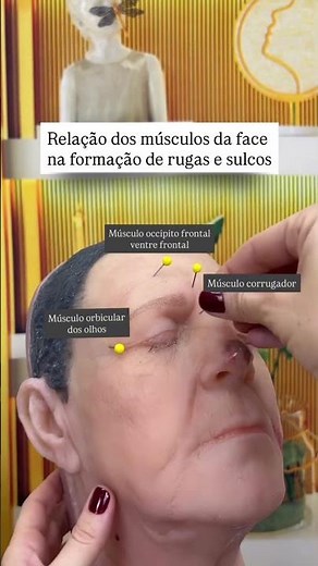 Anatomia da face para harmonização facial | Formação das rugas e sulcos #harmonizacaofacial