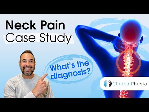 Neck Pain Case Study | What's the Diagnosis? Expert Physio Explains All the Clinical Reasoning!