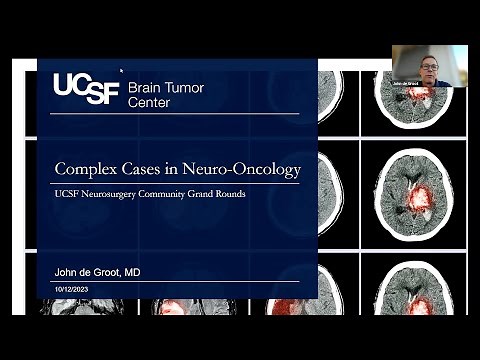 Complex Cases in Neuro-Oncology | UCSF Community Grand Rounds