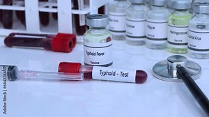 Typhoid test to look for abnormalities from blood, scientific experiment