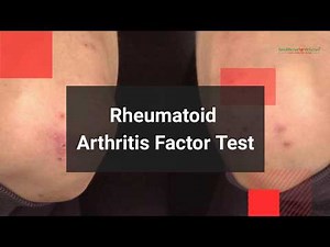 📽️ What is Rheumatoid Arthritis Factor Test? Why RA Factor Test Advised?