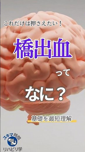 【基礎】橋（脳幹）出血ってなに？PTなら知っておきたい基礎 #理学療法士国家試験 #理学療法士 #作業療法士国家試験 #作業療法士 #基礎 #脳 #脳出血 #脳卒中 #橋出血 #脳幹出血
