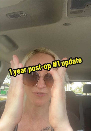 1 Year Post-Op Update on My Hand Surgery