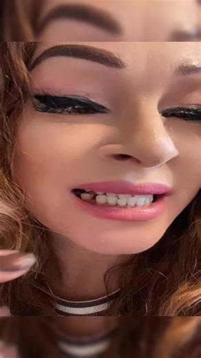 Fix a broken tooth with three easy steps. #faketeeth #dentures #thermal #teethreplacement #moldablefalseteeth