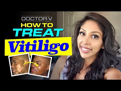 Doctor V - How To Treat Vitiligo | Skin Of Colour | Brown Or Black Skin