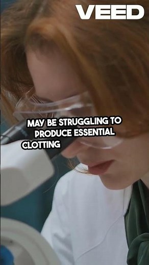 Understanding Prothrombin Time Liver & Bleeding