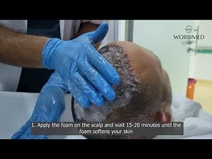 How to remove scabs after 10 days hair transplant | Hair Transplant Turkey