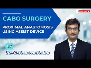 CABG Surgery – Proximal Anastomosis Using Assist Device | Dr. G Praveen Prabu