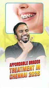 Patient Testimonial | Real Smile Transformation Experience at SDC Clinic 🦷| Senthil Dental Care