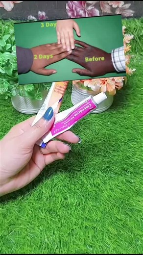 Hand & Foot Whitening Cream for Brighter Skin