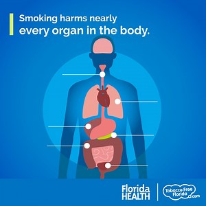 Cigarette smoking can cause 12 types of cancer, heart disease, lung disease, and other harmful diseases. Protect your body and improve your health by quitting smoking. Learn how smoking can harm your health at TobaccoFreeFlorida.com/Effects. | Tobacco Free Florida | Facebook