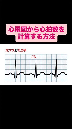 たばえもんナース塾(You Tuber) on Instagram: "心電図から心拍数を計算する方法 #国試 #看護学生 #合格 #実習 #看護 #不整脈 #心電図 #看護師国家試験"