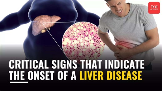 Critical signs that indicate the onset of a liver disease