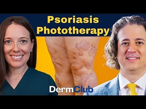 Benefits of Phototherapy for Psoriasis